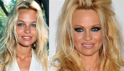 pamela anderson silicone|60 years after first breast op, we look back at history of silicone ...